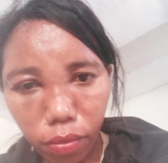 Lakukan Kekerasan Terhadap Karyawati, Security PT USP Ketapang Dipolisikan